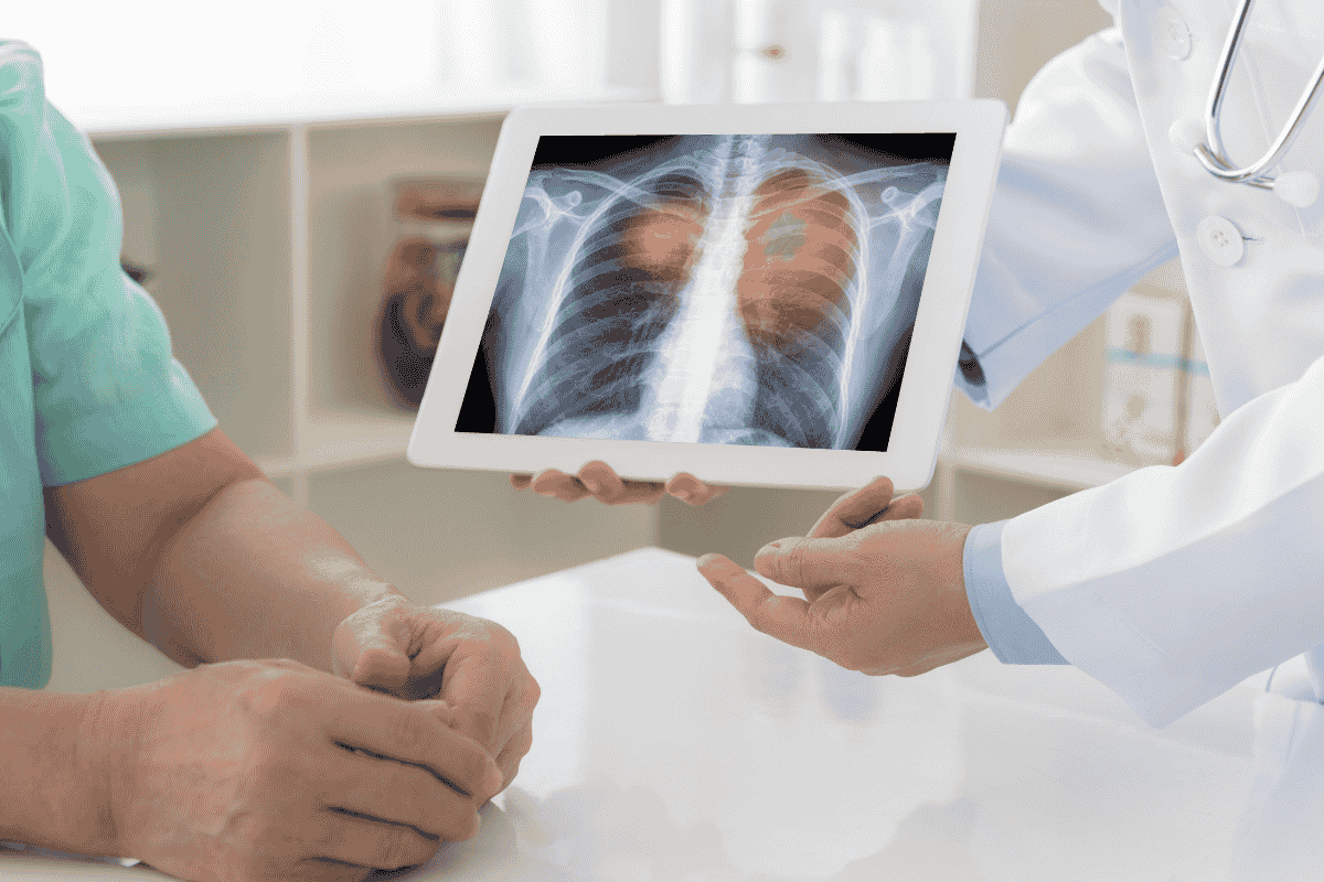 Early Signs of Lung Cancer_